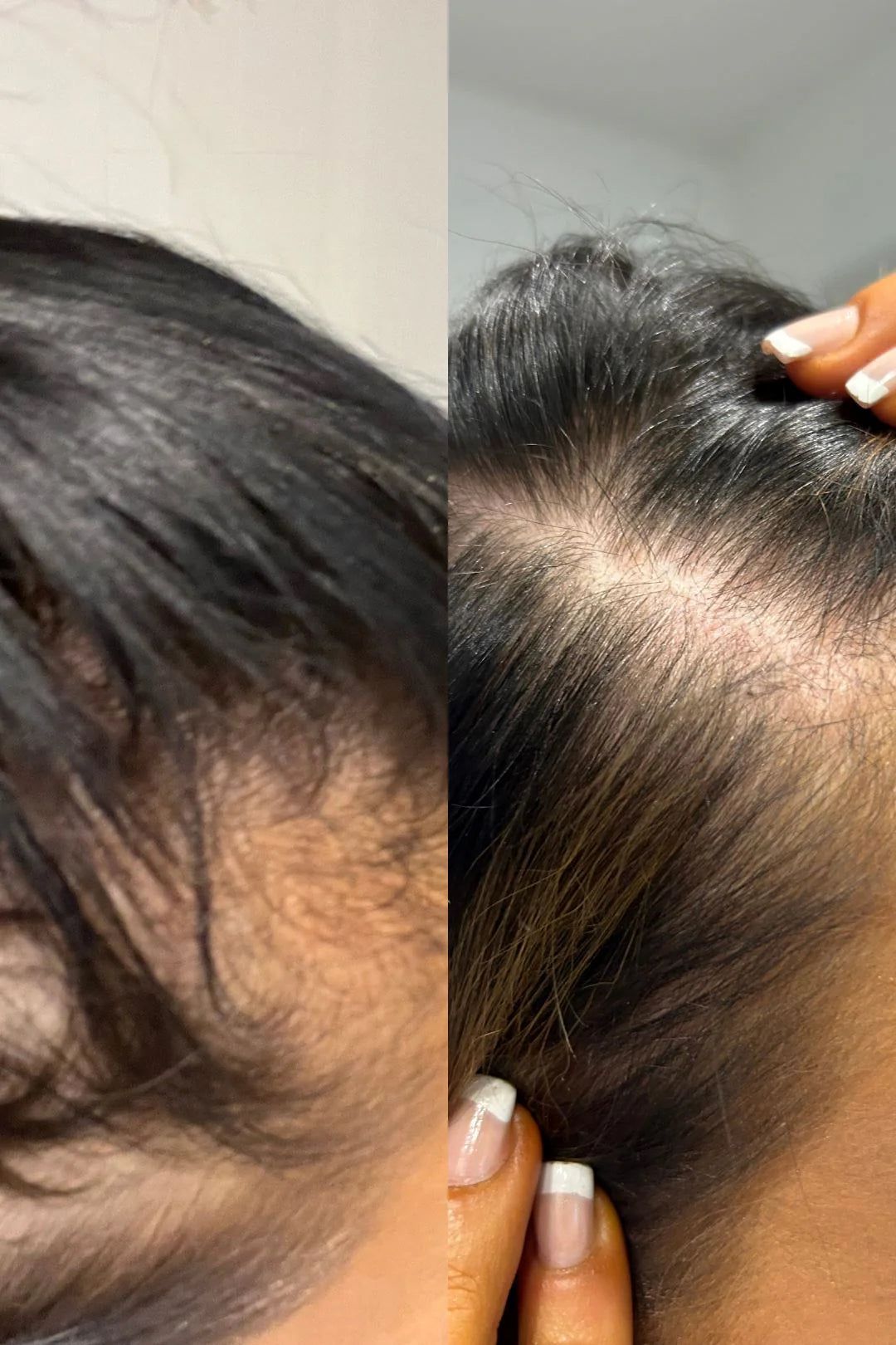 VANI-T Gloss Hair Growth Shampoo